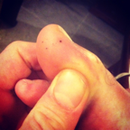 Sea Urchins!!